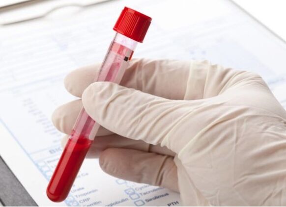 Métodos de diagnóstico de laboratório permitem identificar microflora ou vírus patológicos